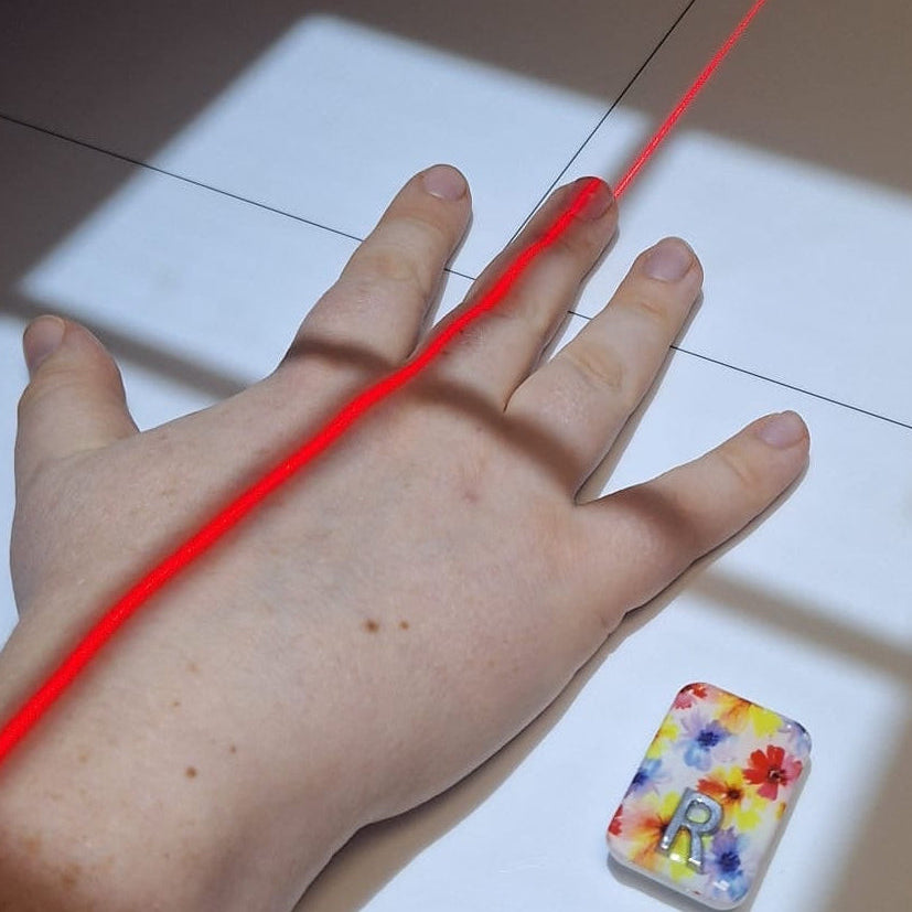 PICTURE OF A HAND X RAY WITH AN X RAY MARKER NEXT TO THE HAND DESINED BY X RAY VISION UK